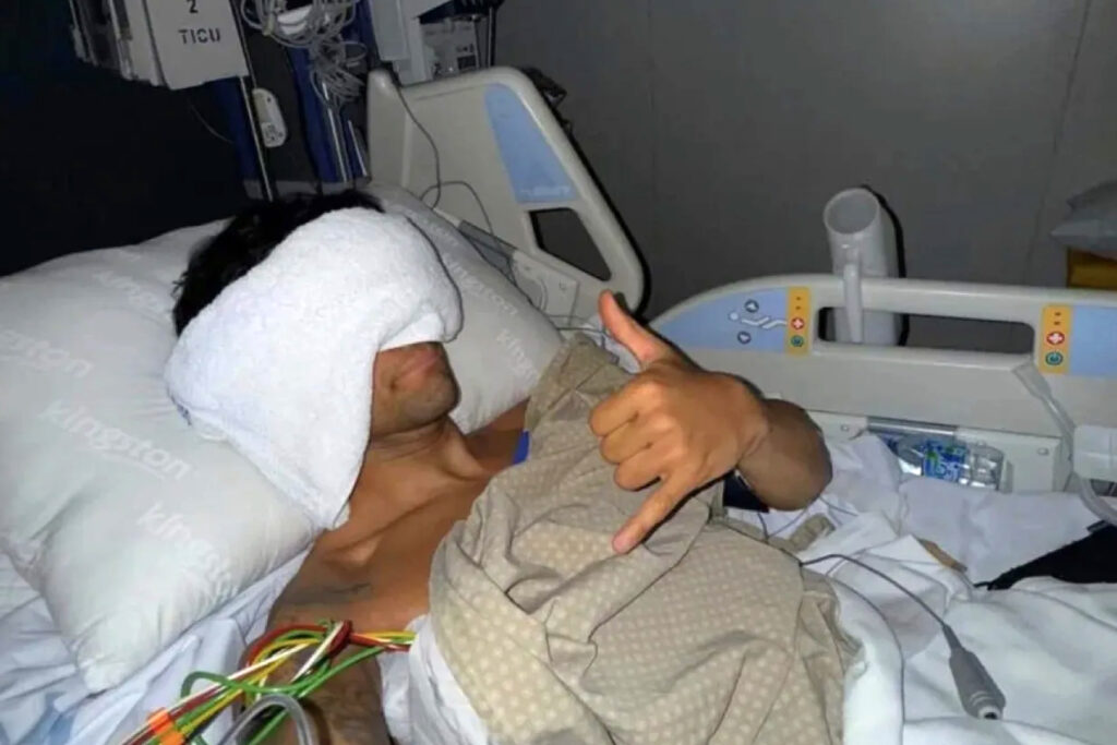 Jorge Martin Alami 11 Tulang Rusuk Patah dan Paru-Paru Kolaps