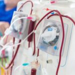 BPJS tanggung biaya cuci darah