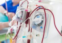 BPJS tanggung biaya cuci darah