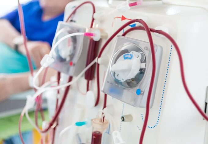 BPJS tanggung biaya cuci darah