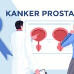 Kanker Prostat Bisa Serang Anak Muda