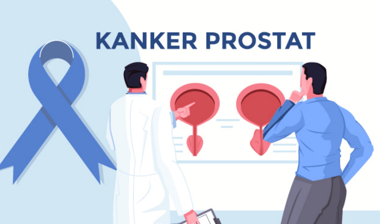 Kanker Prostat Bisa Serang Anak Muda