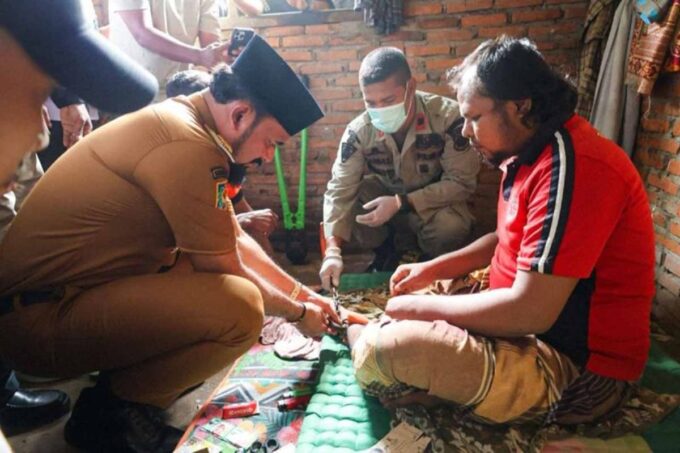 Sebelas ODGJ di Aceh Timur dibebaskan dari pasungan. Foto: Pemkab Aceh Timur