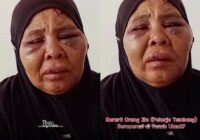 Nenek Saudah korban penganiayaan