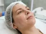 Tak Hanya Wajah, Ini Manfaat Chemical Peeling untuk Atasi Masalah Kulit Tubuh