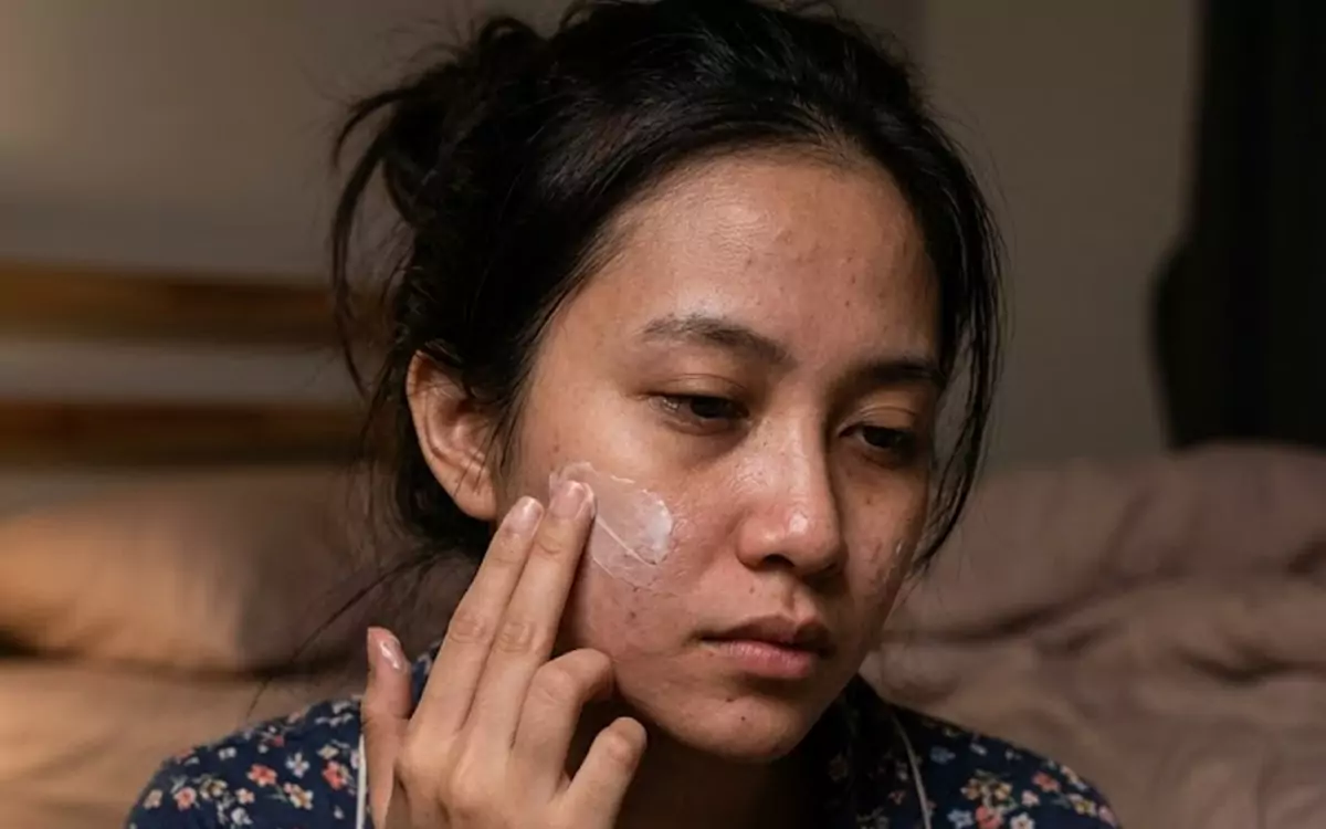 Wajah Kusam